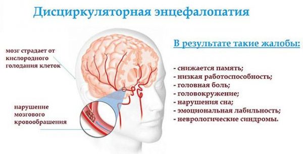 Энцефалиты неврология презентация